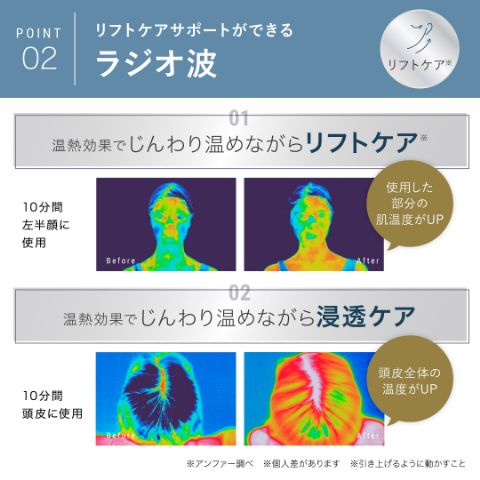 スカルプD ボーテ　スカルプ電気ブラシの商品画像