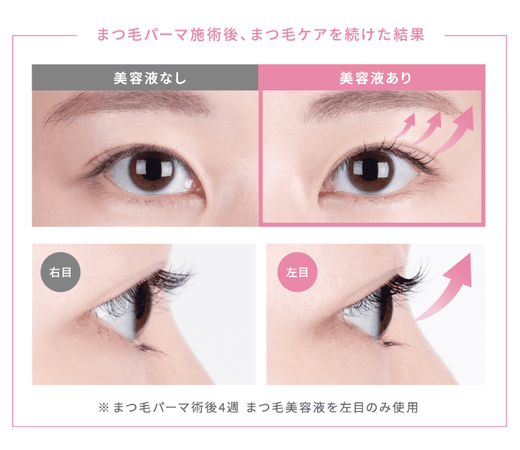 BBS ままならない マークツヤ有 センターキャップ RG用 14.15  